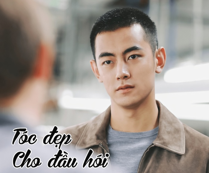 Hói chữ m để tóc gì