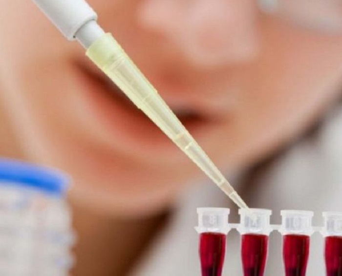 Huyết thanh tế bào gốc trị nám