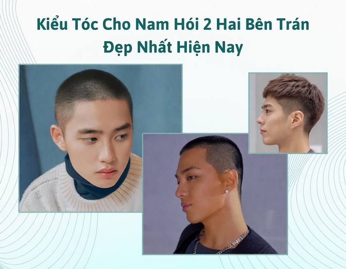 Kiểu tóc cho người hói 2 bên trán nam