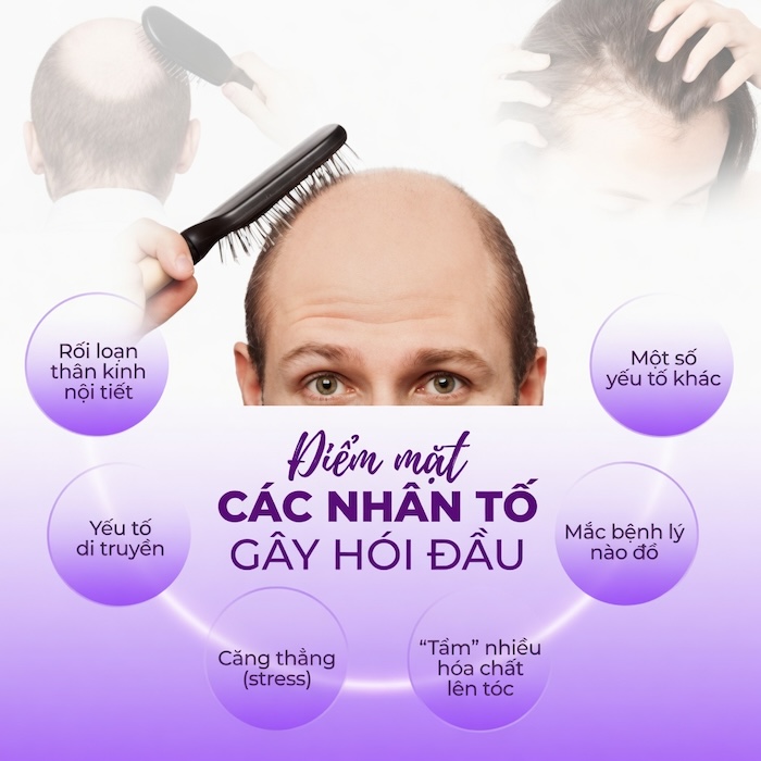 Nguyên nhân gây hói đầu