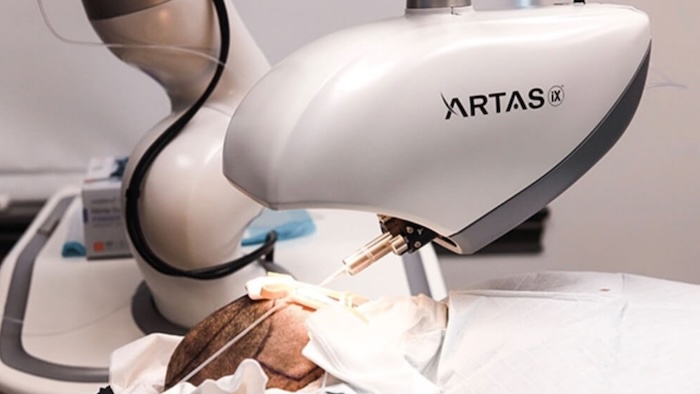 Robot cấy tóc artas