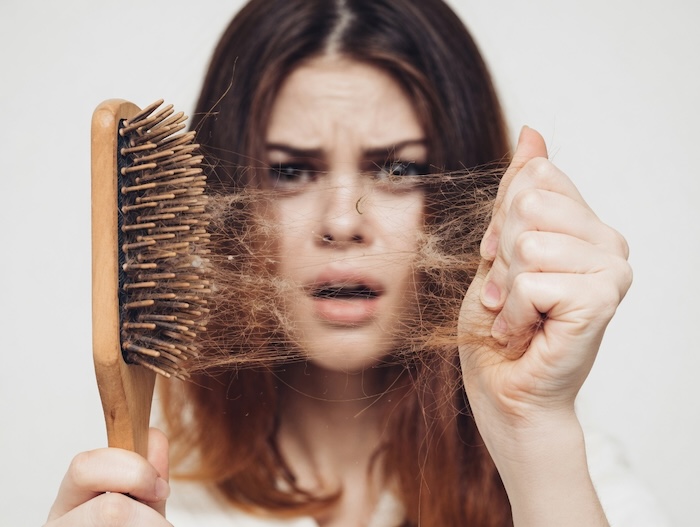 Rụng tóc hói đầu