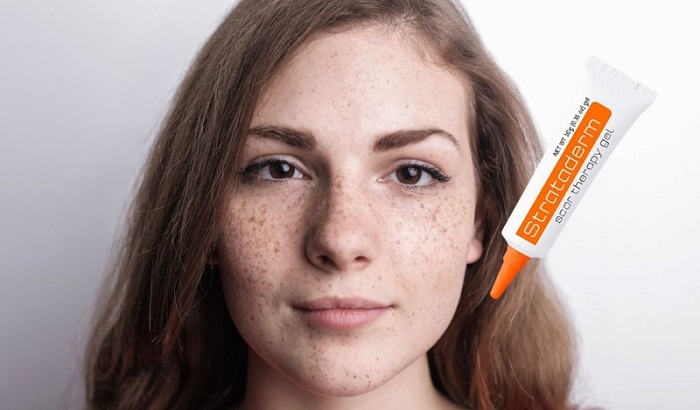 Strataderm 10g trị nám