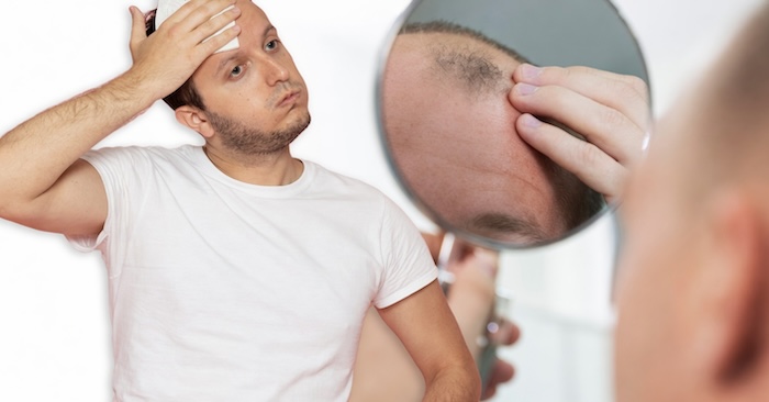 Thuốc trị rụng tóc hói đầu Thuốc trị rụng tóc hói đầu
