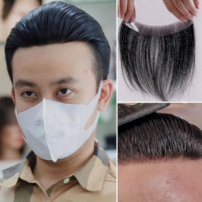 Tóc dán mái hói chữ m