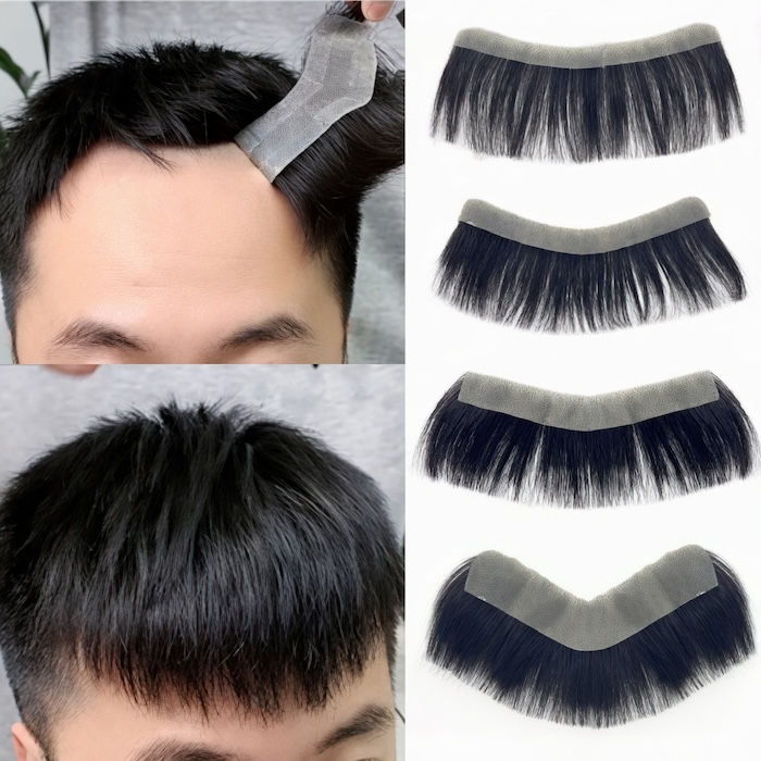 Tóc giả mái hói chữ m
