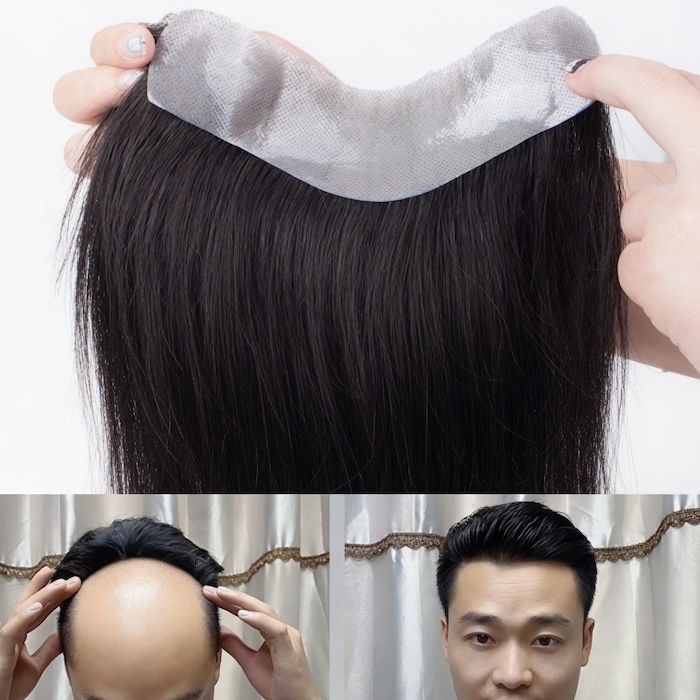Tóc giả mái hói nam Tóc giả mái hói nam