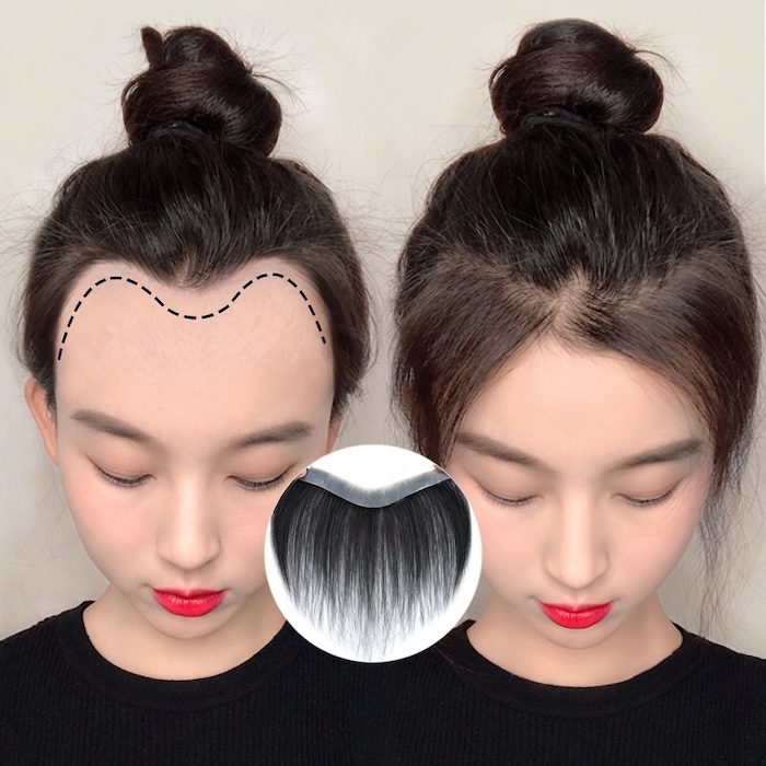 Tóc mái che hói chữ m Tóc mái che hói chữ m