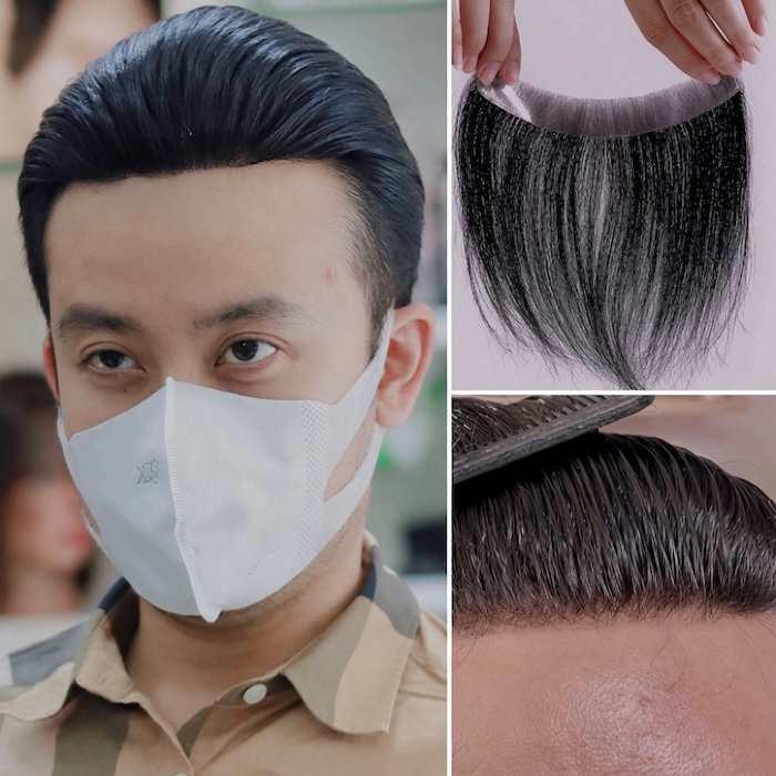 Tóc mái hói chữ m