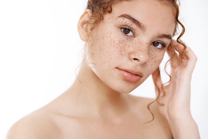 Chữa nám mặt bằng diện chẩn