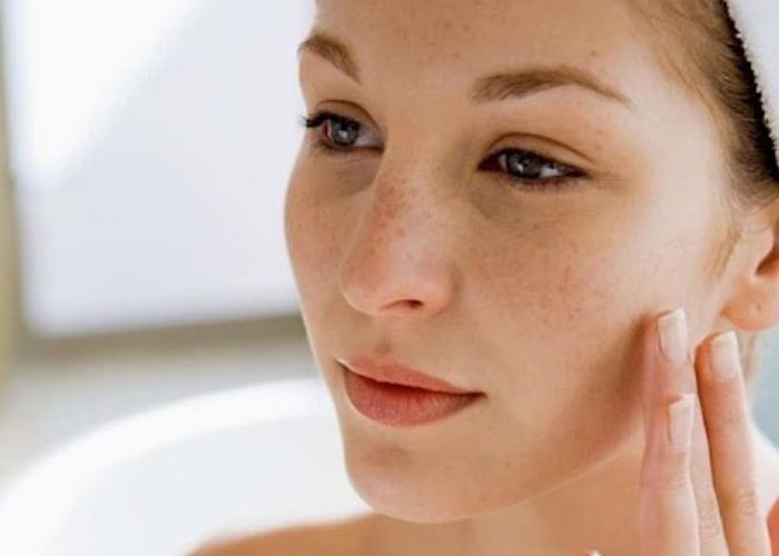 Dừa có trị nám được không