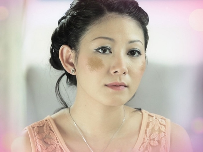 Kem trị nám chân sâu hàn quốc