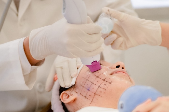 Công nghệ thermage có tốt không