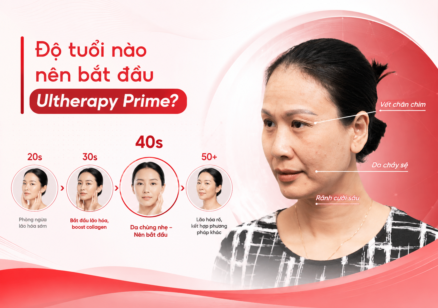 Hifu ultherapy là gì