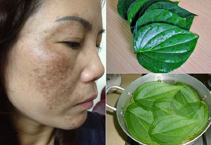 Làm mờ nám bằng lá trầu không