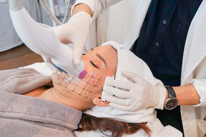 Máy nâng cơ rf thermage Máy nâng cơ rf thermage