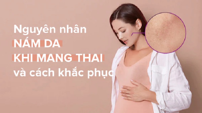 Nguyên nhân gây nám da khi mang thai