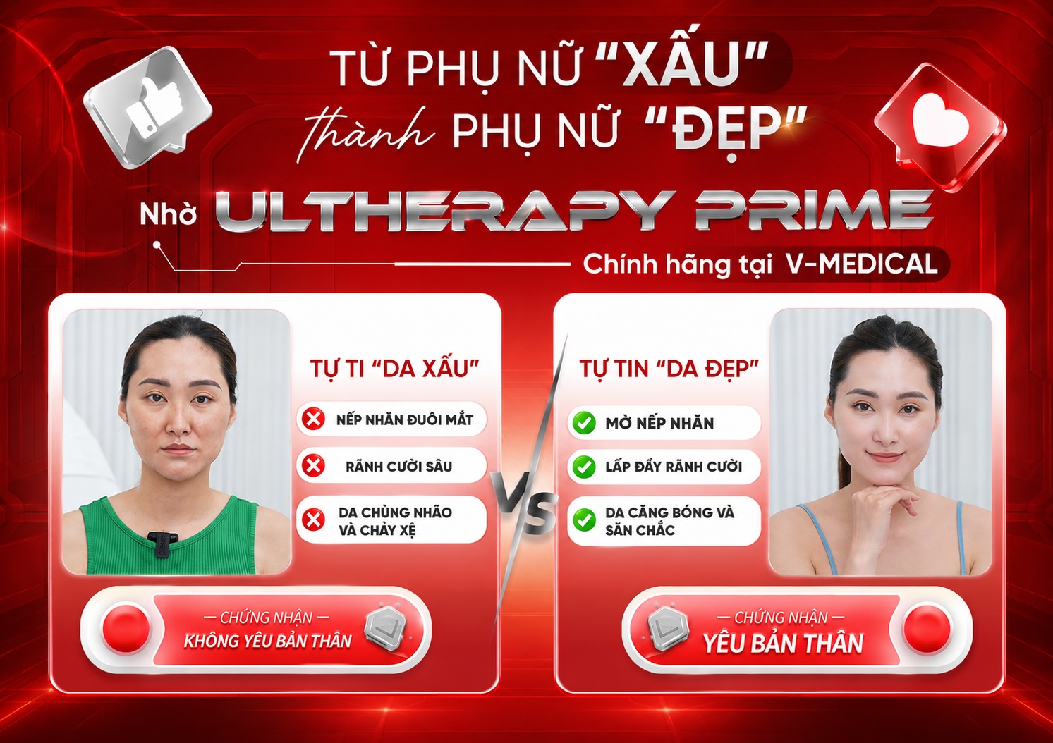 Phương pháp ultherapy