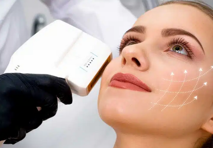 Thermage khác gì hifu