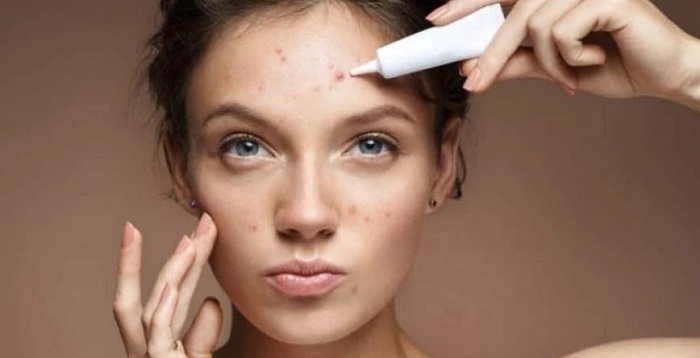 Trị mụn hay trị nám trước