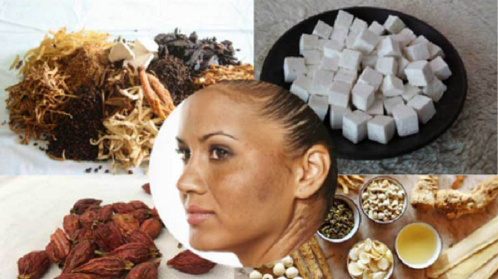 Trị nám chân sâu bằng đông y