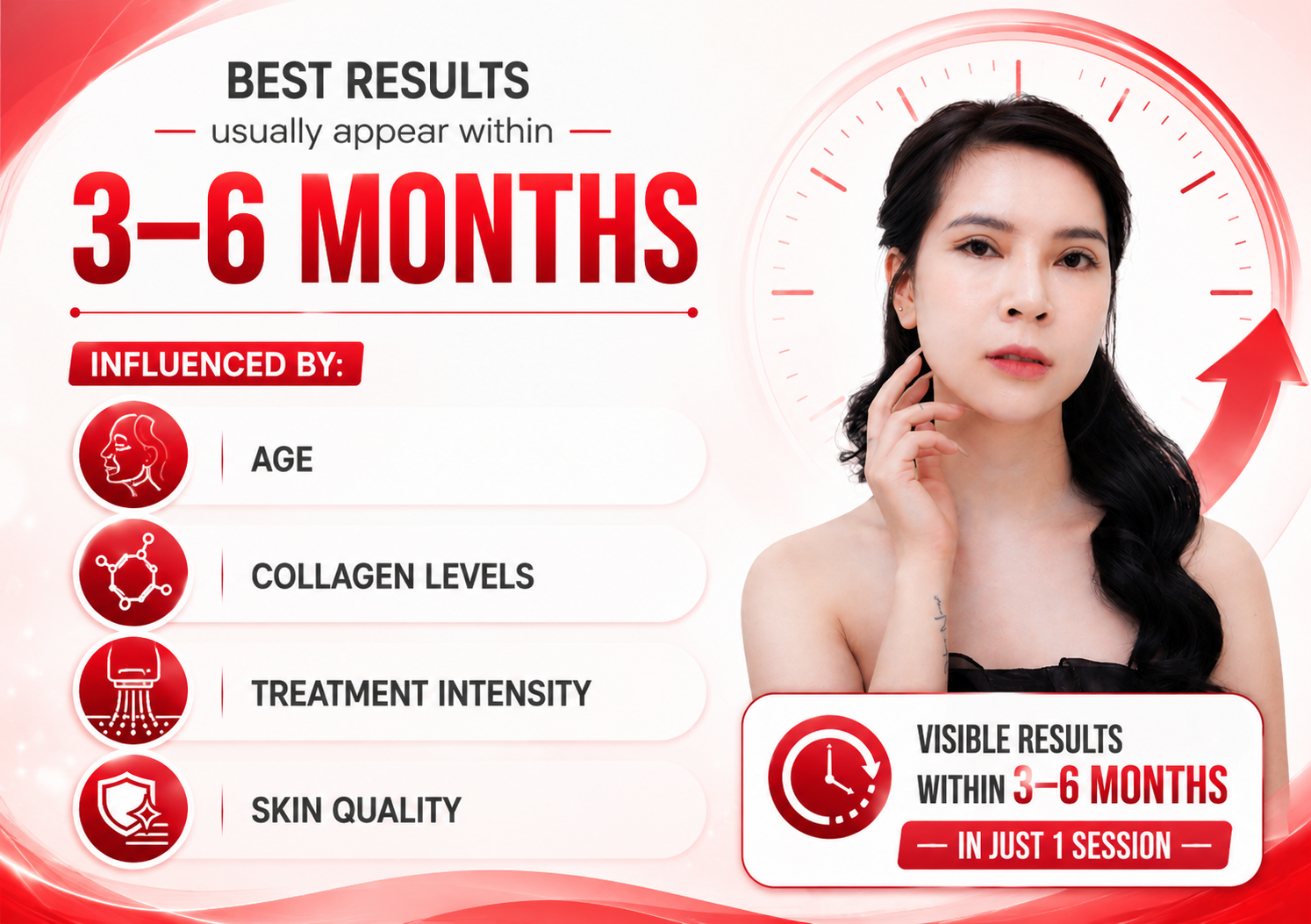 Ultherapy Hanoi Ultherapy Hanoi