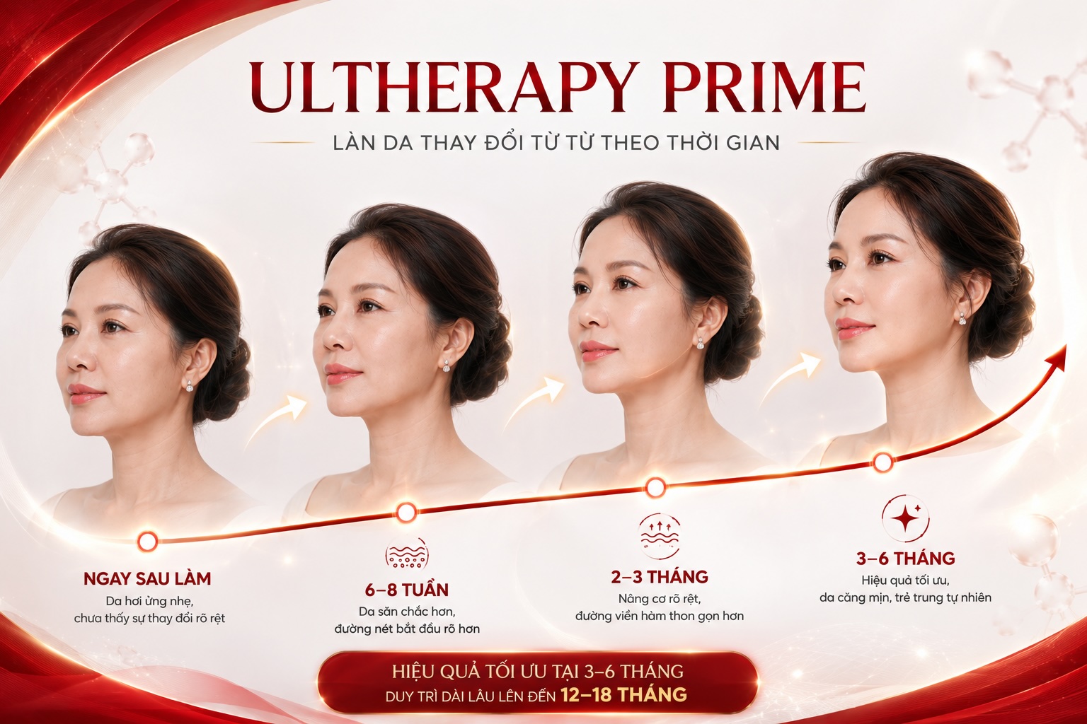 Ultherapy khác gì hifu Ultherapy khác gì hifu