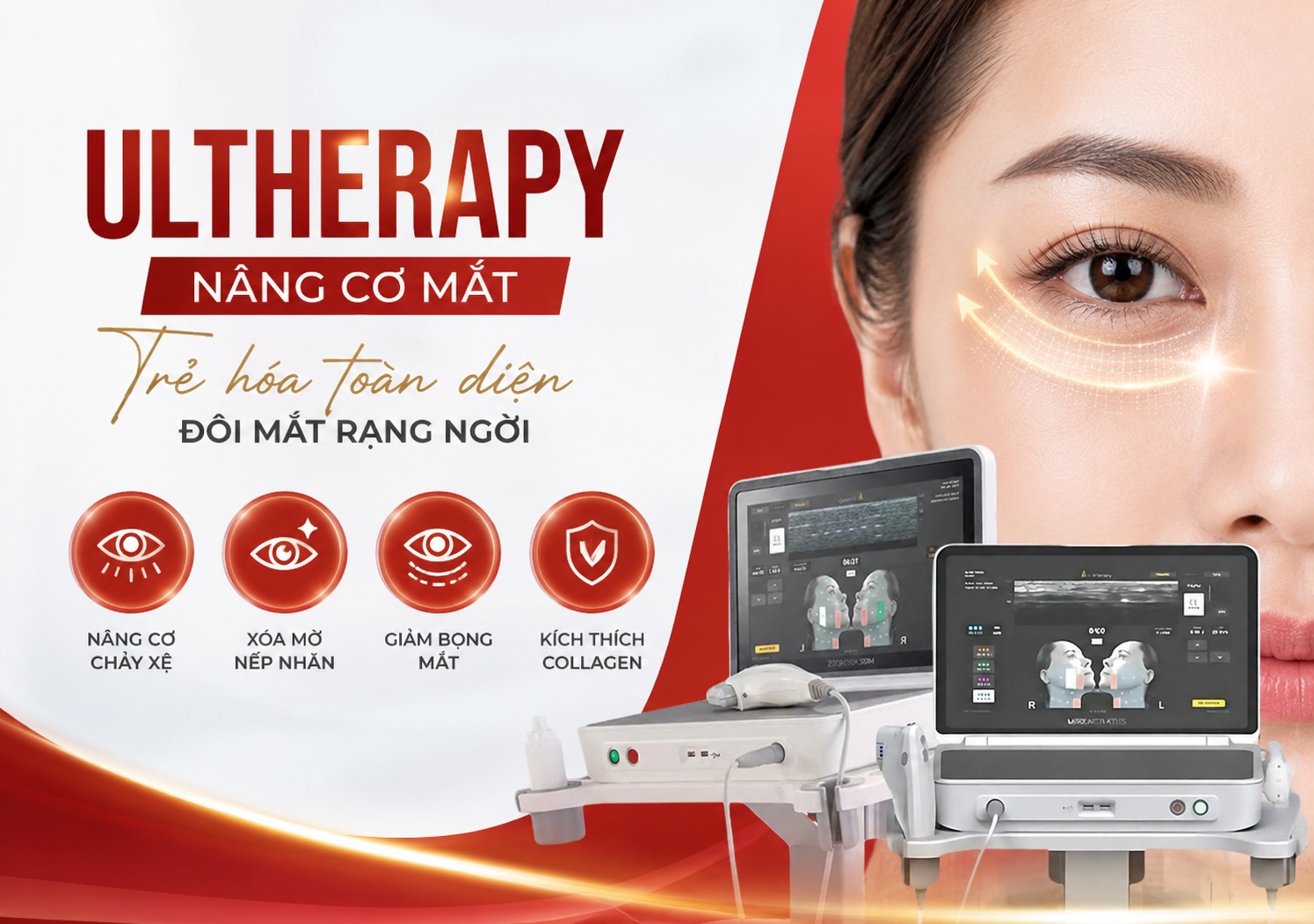 Ultherapy vùng mắt Ultherapy vùng mắt