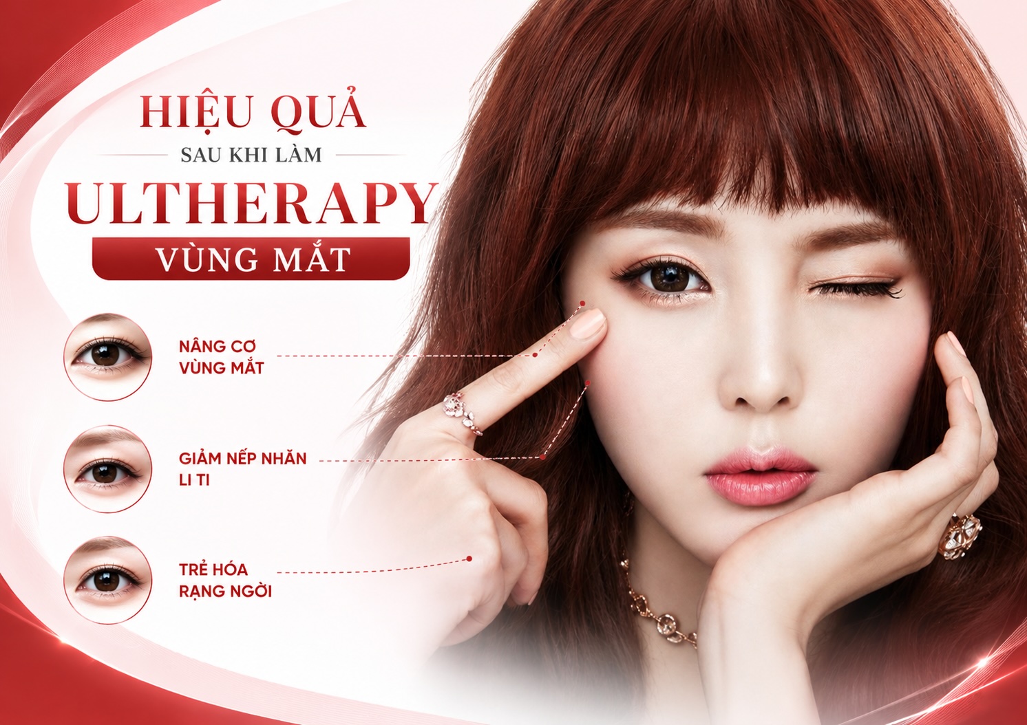 Ultherapy vùng mắt Ultherapy vùng mắt